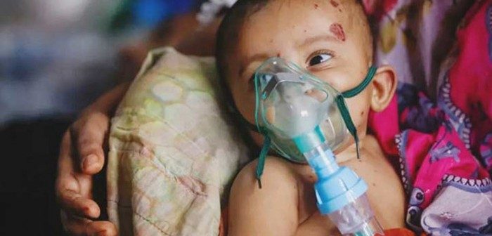 9 more children die of measles and measles symptoms